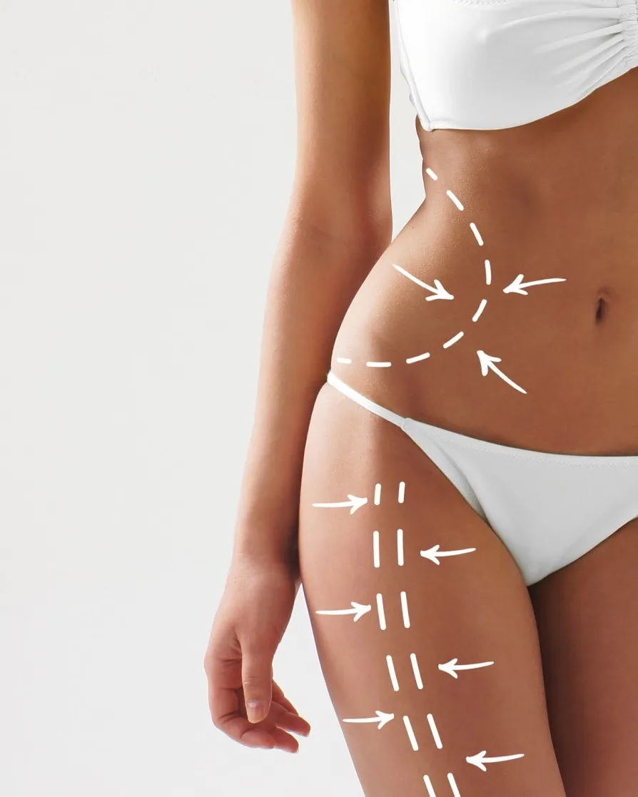 metodo gracy shape slimming_